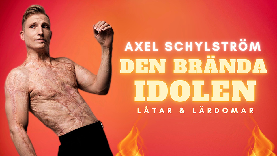 En ung man med bar överkropp. Han har stora ärr efter brandskada.