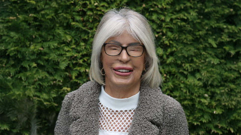 En kvinna med vit pagefrisyr och mörkbågade glasögon.